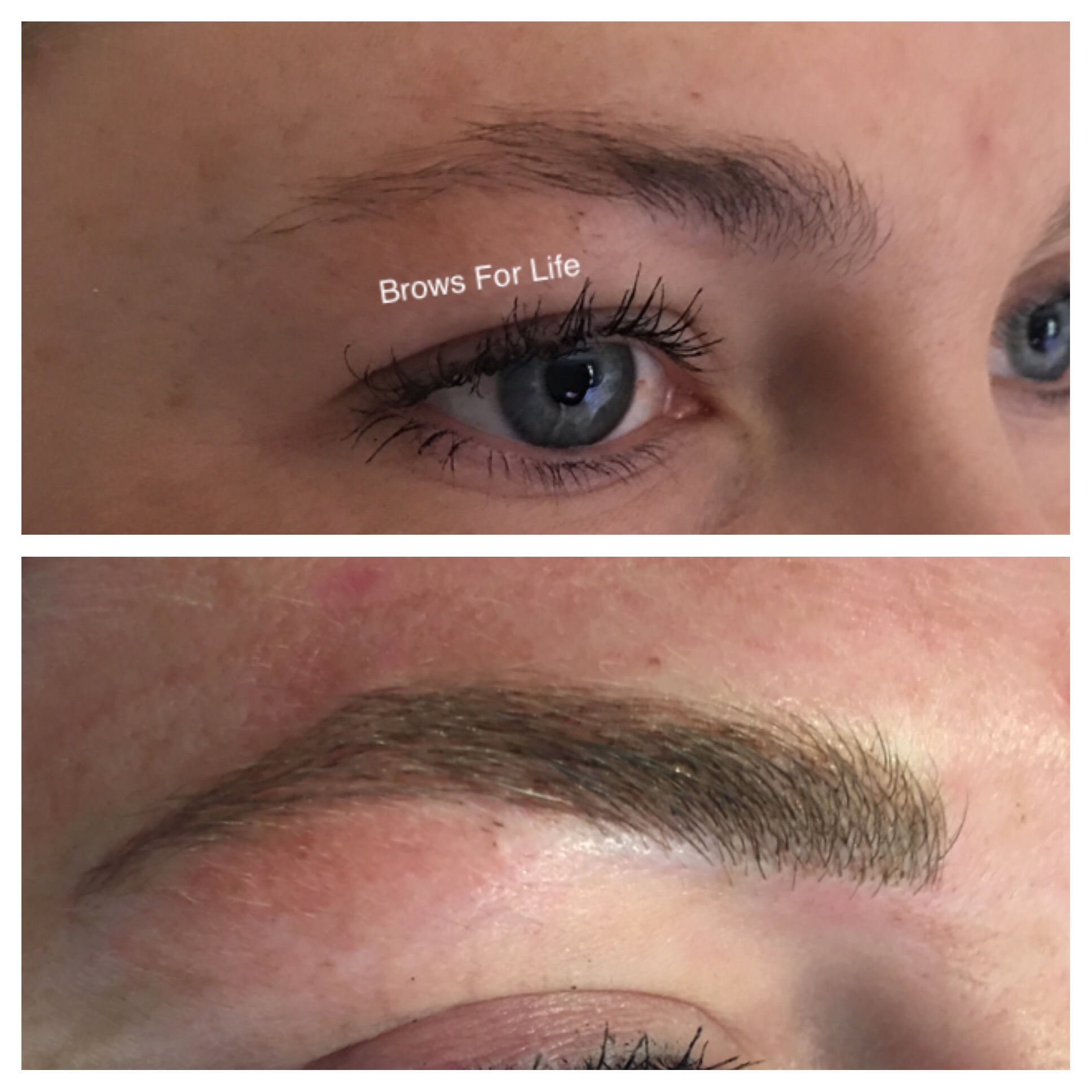 Brow transformation